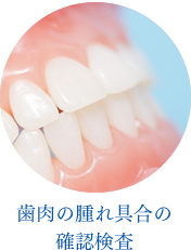 歯肉の腫れ具合の確認検査