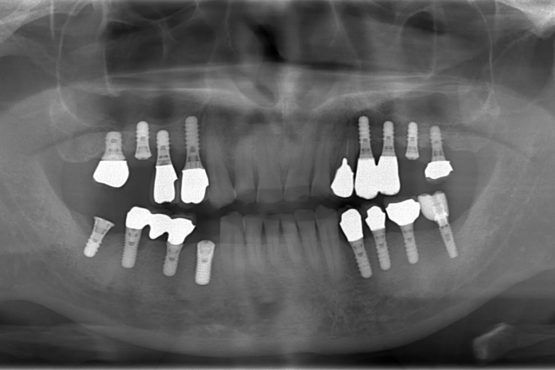 院長のレントゲン写真